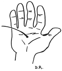 poil sur la main.gif