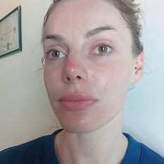 Facial skincare treatment for sun-damaged and uneven-looking skin