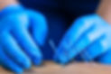Close up of a needle and hands doing dry needling..jpg