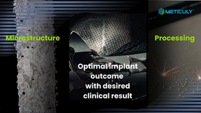 Characterising 3D-Printed metallic glasses : Unlocking performance through microstructure in additive manufacturing