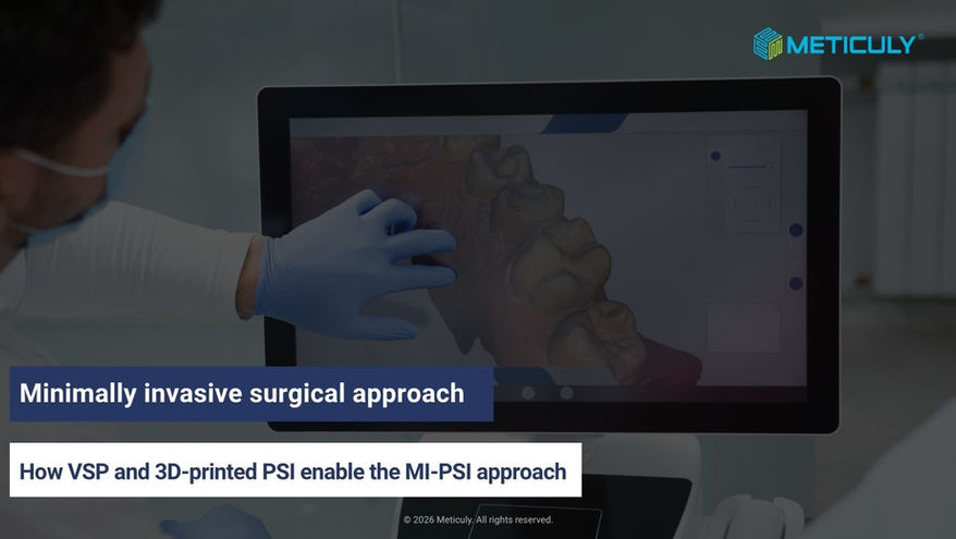 How VSP and 3D-Printed PSI Enable the MI-PSI Approach for Orthognathic surgery