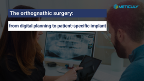 Standard plate vs. Patient-specific plate