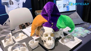 Meticuly 3D-printed cranioplasty implants displayed on a table at a medical conference, with a large skull model wearing a colourful hat in the background.