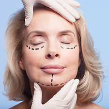 Plastic Surgery Marks