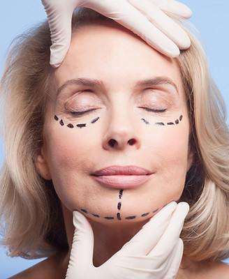 ניתוחים פלסטיים