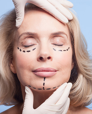 Before Surgery 