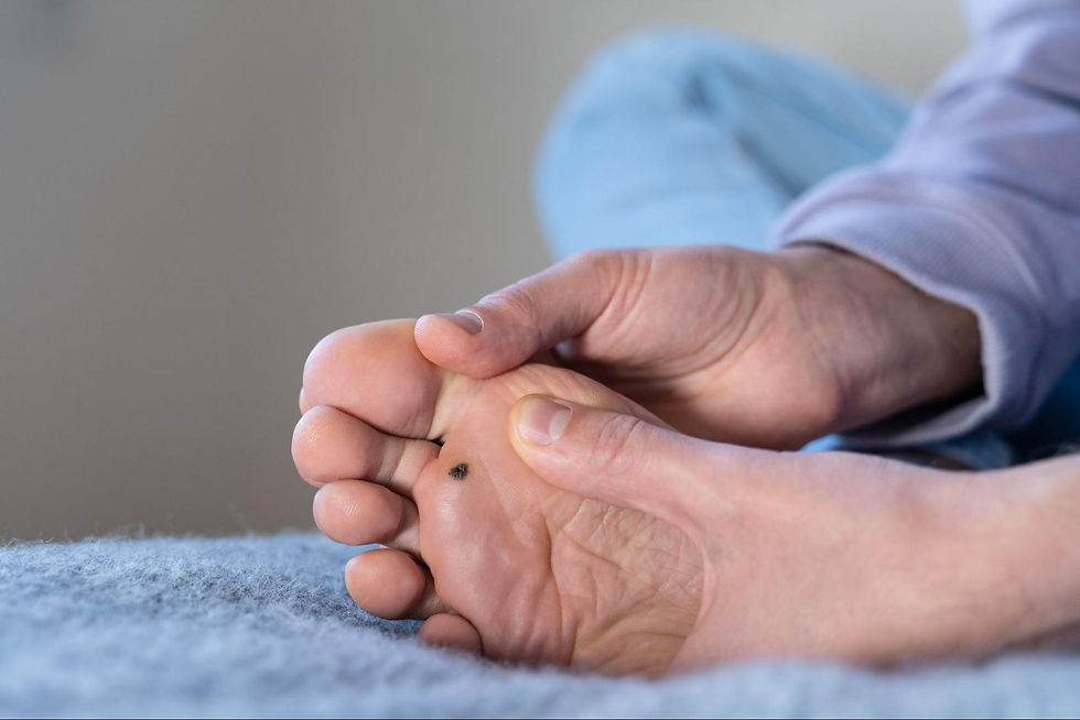 A man examining a plantar wart on the bottom of his foot after wart treatment.