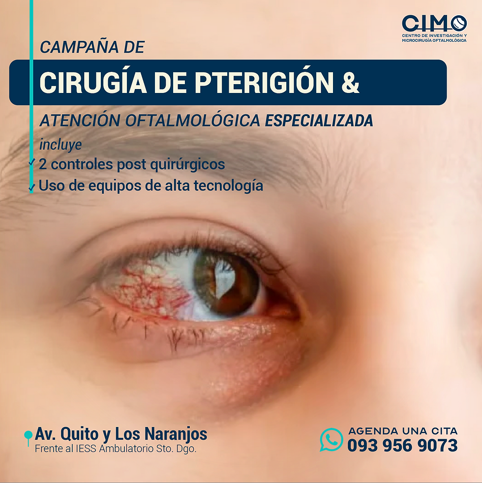 Cirugías de pterigión