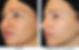 Clear+and+Brilliant+Laser+Facial+(4).png
