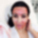 Microneedling+Treatments+Miami+(4).jpg