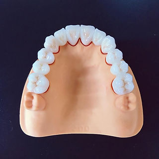 Zirconia Bridge4.jpeg