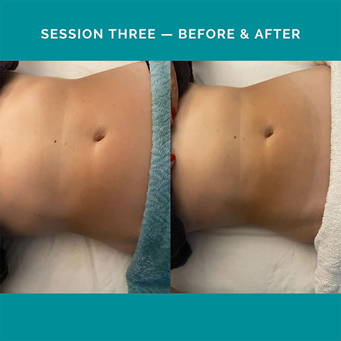 Lymphatic-Drainage-Treatment-Before-and-After-Client-1.jpg