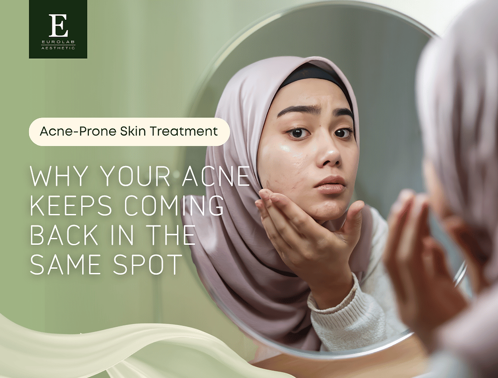 Why Your Acne Keeps Coming Back in the Same Spot