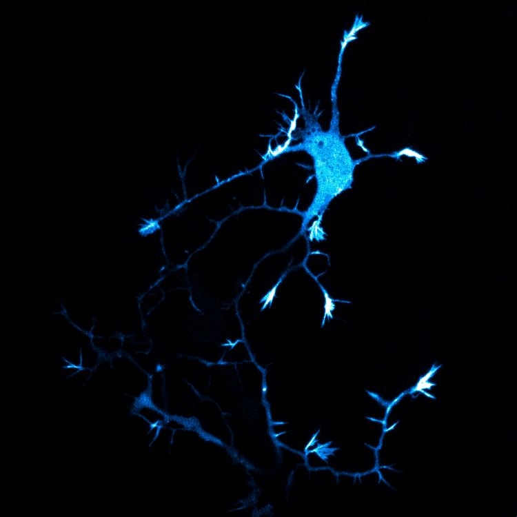4cbc9ce6e8c9a951ae5b9f366aef5e69.gif