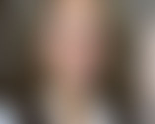 The Downside to Pellets for HRT