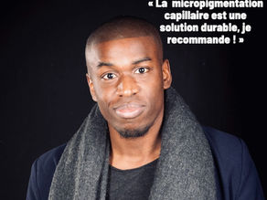 Comprendre les causes des cheveux clairsemés chez l’homme