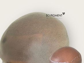 Qu’est-ce que le tatouage capillaire pour homme