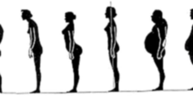 Sway_Back_Posture_A_Common_Postural_Variation (1)_edited.jpg