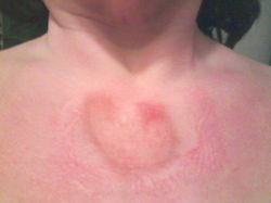 How Lupus affects you (9).jpg