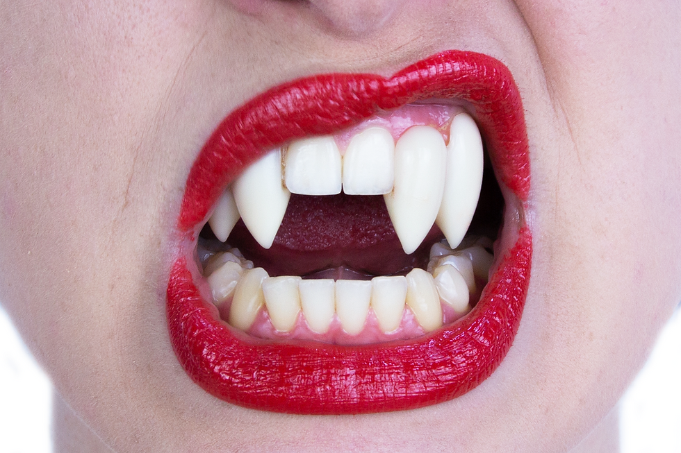 Thumbnail: Scarecrow Shredders Double Deluxe Custom Fangs in a person's top canines and incisors 