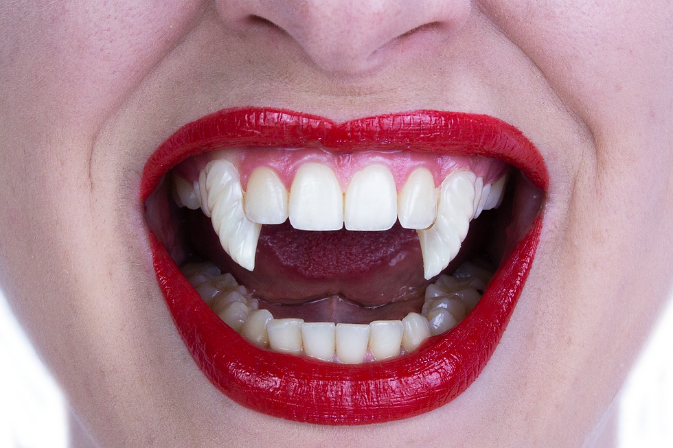 Thumbnail: Scarecrow Spiral Deluxe Custom Fangs on a persons upper canine teeth