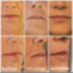 Lip journey
