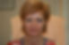 Facelift before