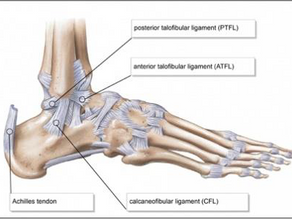 Ankle Sprains - serious or should I just run it off?