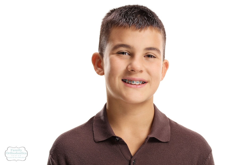 Smiling teenage boy with braces, showcasing progress in Braces for Overbite in Avon and Torrington, CT.