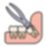 teeth extraction at Dr. Pragna's Max Care Dental
