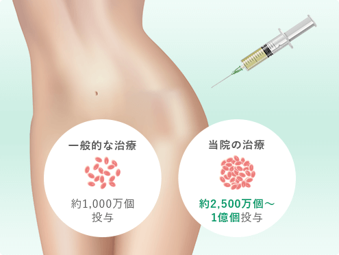 幹細胞治療髖關節