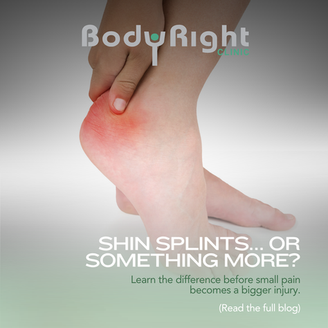 Shin Splints or a Stress Fracture? How to Tell the Difference
