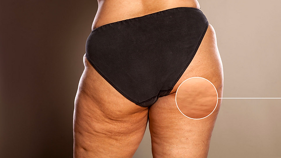 Design sem nome (13).png