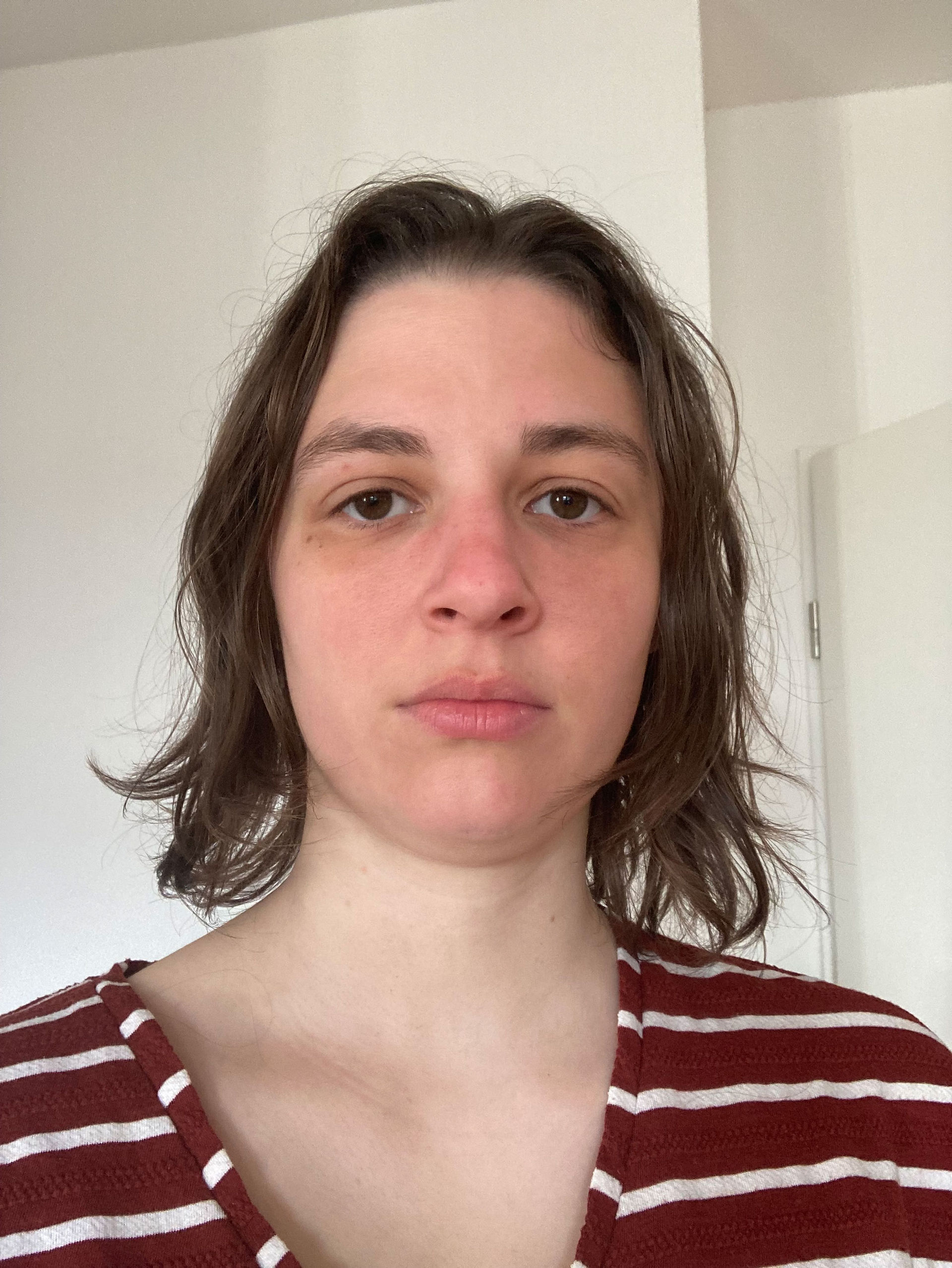 Haare verlieren, Haarverlust, Haarausfall, lichte Haare, Haarausfall behandeln