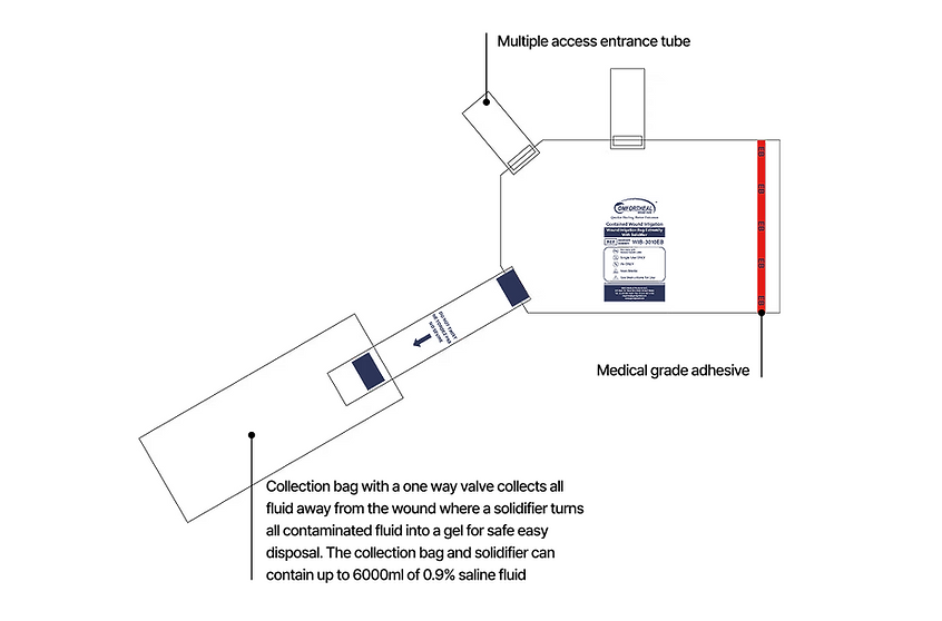 2. EB Model - EN.png