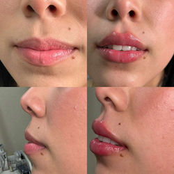 WhatsApp Image 2026-03-09 at 17.52.23