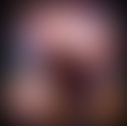 Psychedelics and the Architecture of Forgetting