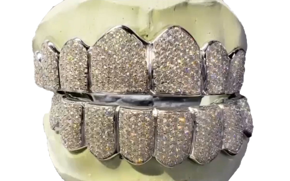 PRINCE 14K WHITE GOLD GRILLZ