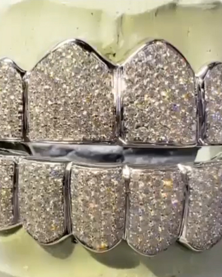 PRINCE 14K WHITE GOLD GRILLZ
