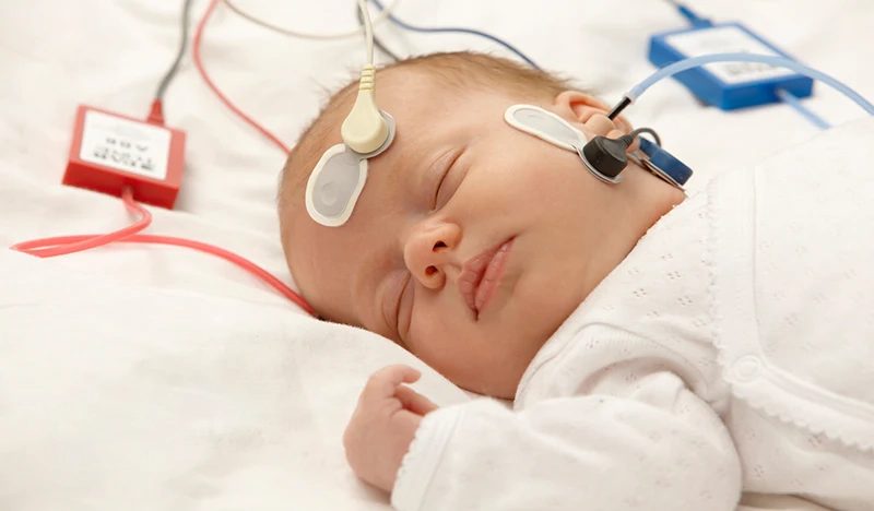 2_Auditory_Brainstem_Response_copy_800x.webp