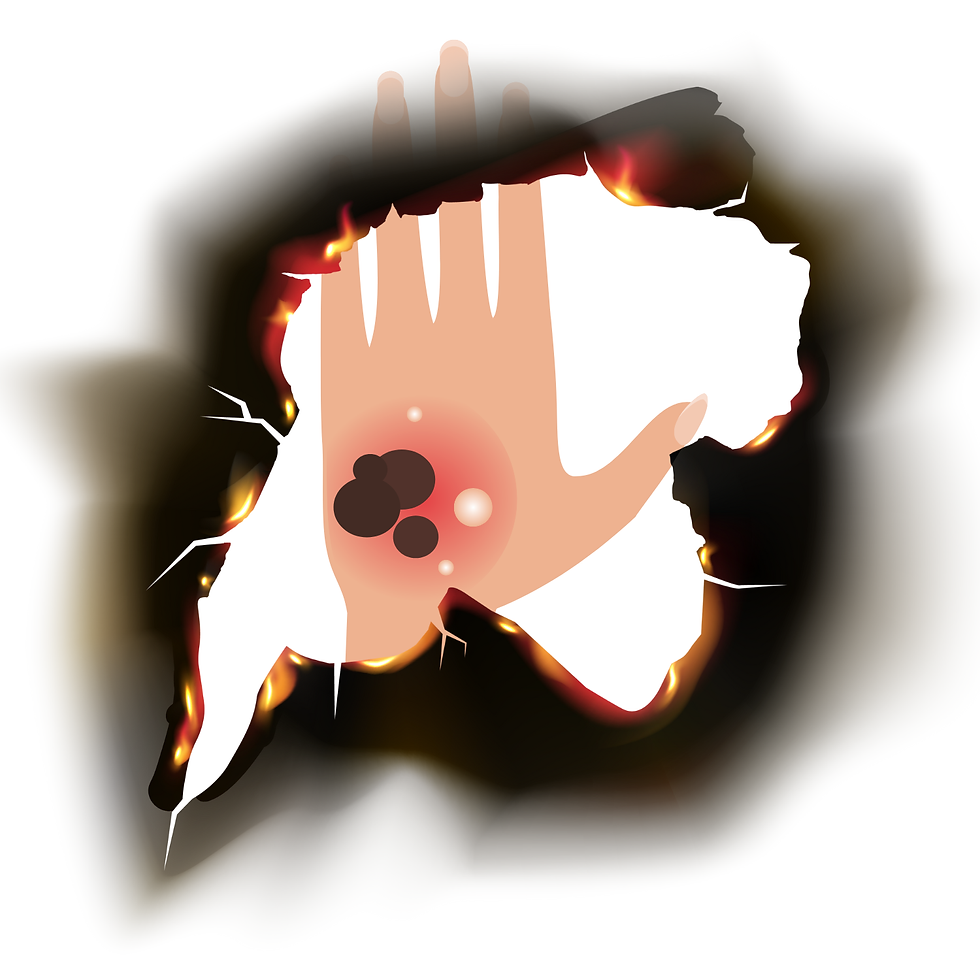 How to Identify Different Types of Burns