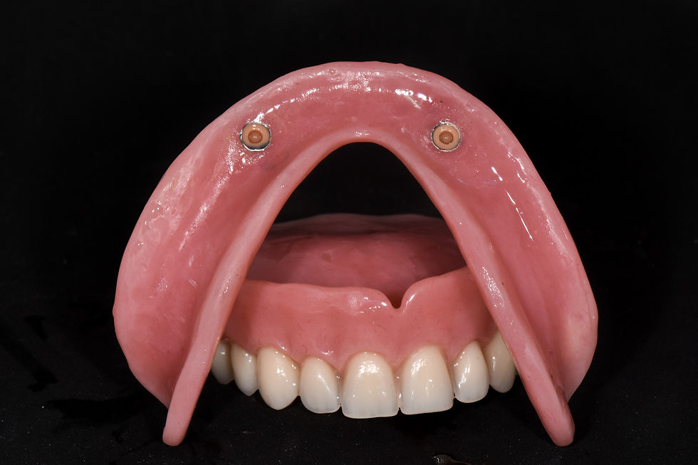 Patentos implantátumos fogsor alsó, íny felé néző oldala.