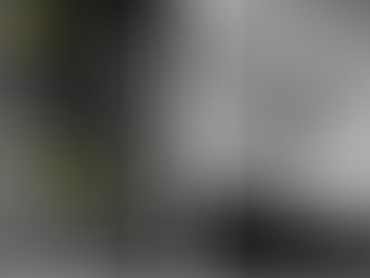 MV2 é regra, não exceção: por que esse pequeno canal faz tanta diferença no sucesso do tratamento de canal?