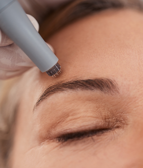 federfein-kosmetik-microneedling(c)-canva.png