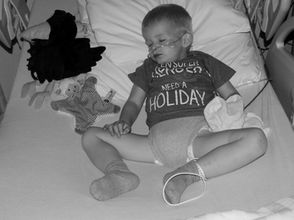 De Psychologie achter zwart- wit  portretten (Door de ogen van een Fotograaf en medewerker in de GGZ)