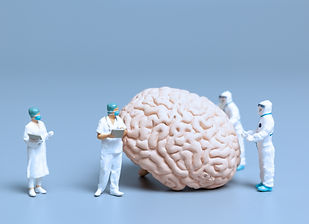 Miniature Doctor checking and analysis alzheimer's disease and dementia of brain, Science