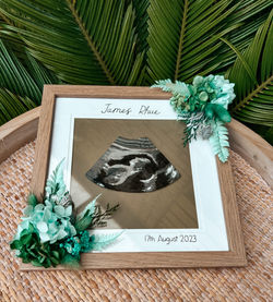 Baby Scans