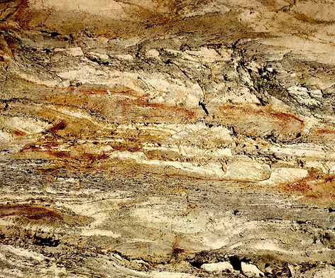 translucent veneer