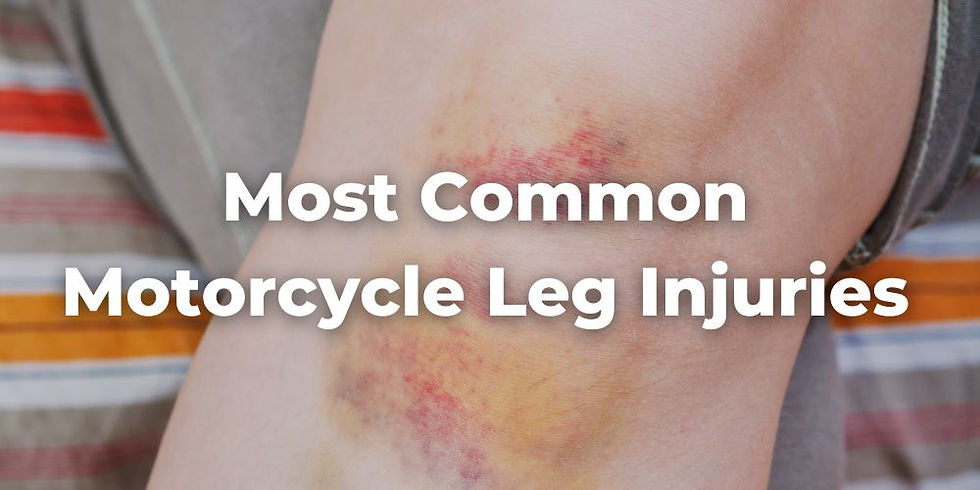 What Are the Most Common Motorcycle Leg Injuries?