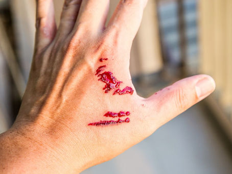 Do Hospitals Report Dog Bites in Tennessee?